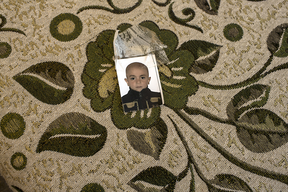 Jordan. Toddler recieves chemotherapy in Jordan, in remission after escaping horrors of Ghouta Chemical attack.
